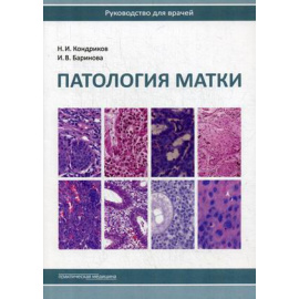 Кондриков Николай Иванович, Баринова Ирина Владимировна. Патология матки. Руководство для врачей
