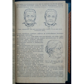 Гофунг Е. Основы протезного зубоврачевания.