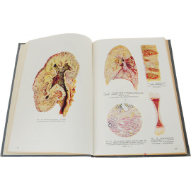 Патологическая анатомия и патогенез болезней человека.Атлас рисунков