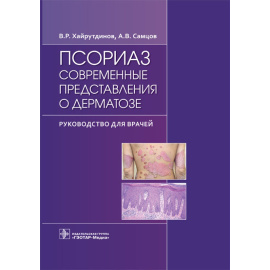 Хайрутдинов В.Р., Самцов А.В. Псориаз. Современные представления о дерматозе