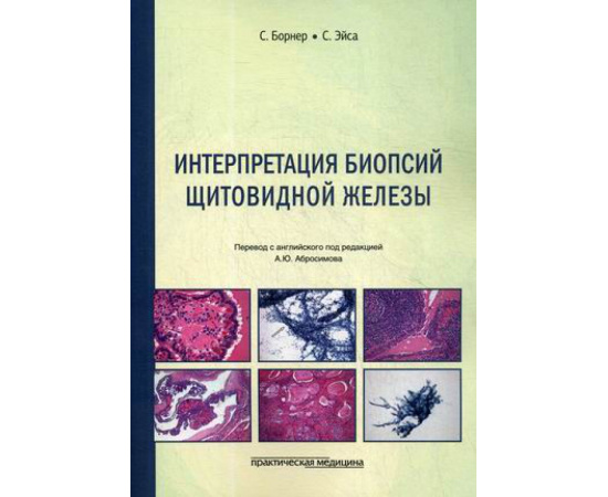 Борнер С., Эйса С. Интерпретация биопсий щитовидной железы.