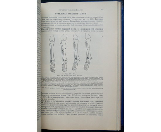 Белер Л. Техника лечения переломов костей.