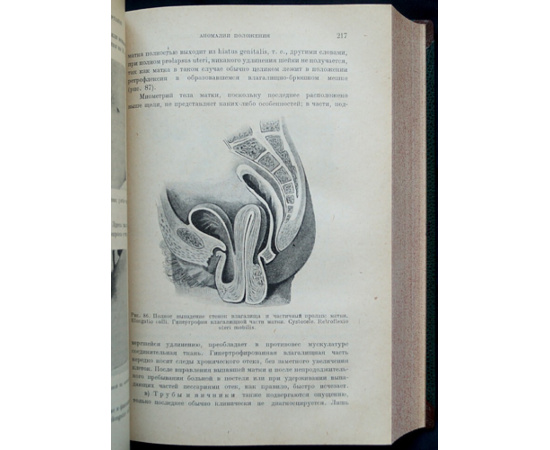 Шредер Р., проф. Учебник гинекологии.