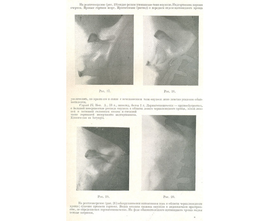 Вестник рентгенологии и радиологии. Том XIV