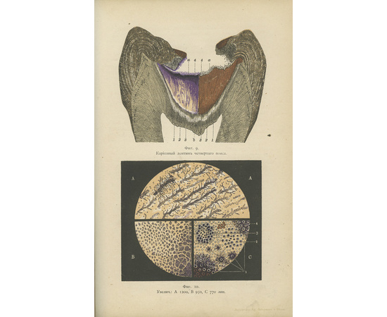 Грубе В.Ф. Руководство к лечению зубных болезней. В 3-х томах (четырех переплетах эпохи).