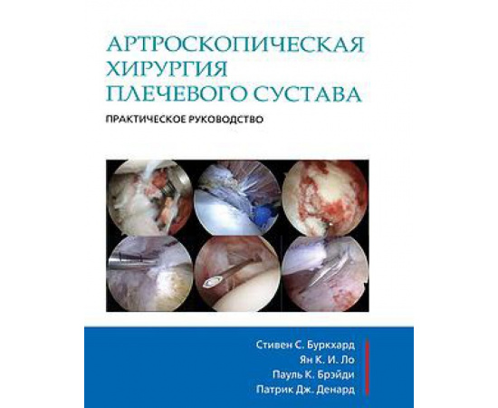 Буркхардт Стивен, Брейди Пауль К., Денард Патрик Дж. Артроскопическая хирургия плеча. Практическое руководство