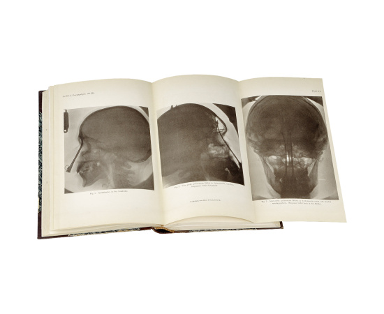 Archiv fur Laryngologie und Rhinologie книга