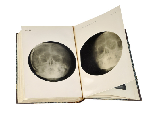 Archiv fur Laryngologie und Rhinologie книга