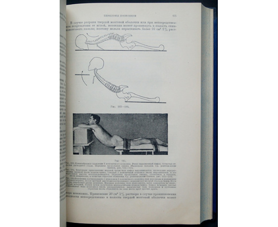 Белер Л. Техника лечения переломов костей.