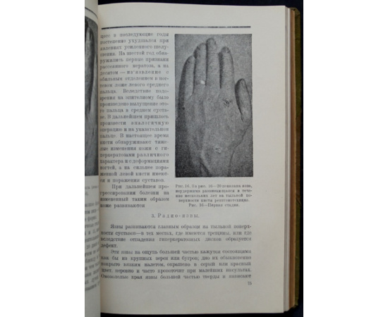 Оппенгейм М., Рилле Ж., Улльманн К. / Oppenheim M., Rille J., Ullmann K. Профессиональные болезни кожи. Том первый: В трех выпусках