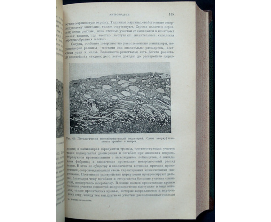 Шредер Р., проф. Учебник гинекологии.
