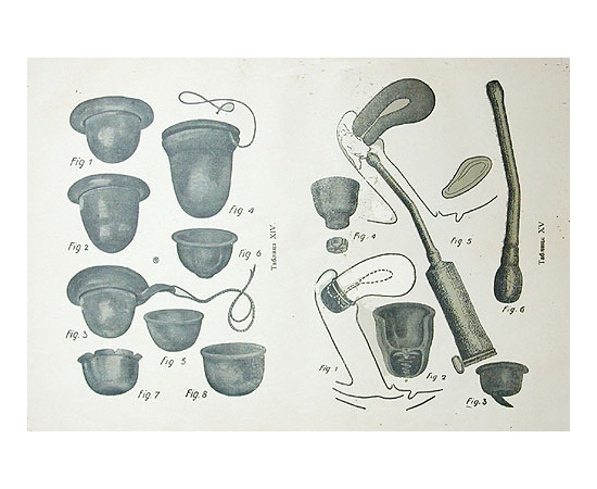 Плодовитость в браке. Меры влияния на плодовитость в желаемом направлении