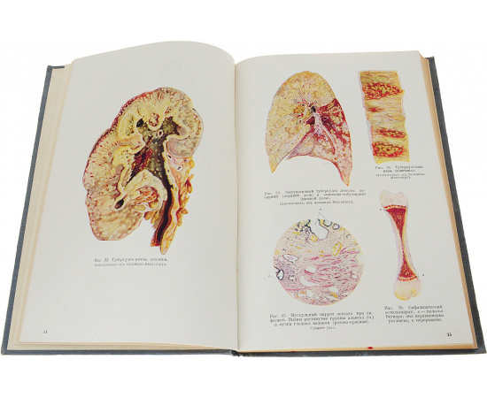 Патологическая анатомия и патогенез болезней человека.Атлас рисунков