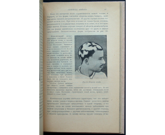 Иозеф Макс. Болезни волос.
