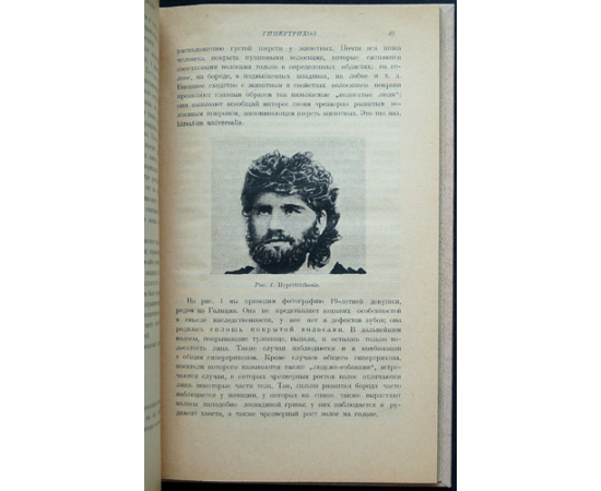Иозеф Макс. Болезни волос.