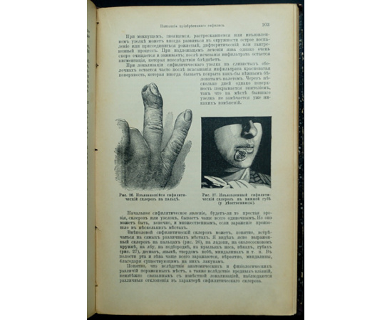 Ланг Э., д-р / Dr. E. Lang Учебник половых болезней.