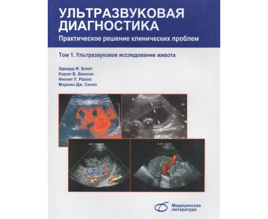 Блют Э., Бенсон К., Раллс Ф., Сигел М. Ультразвуковая диагностика. Практическое решение клинических проблем. Том 1. Ультразвуковое исследов