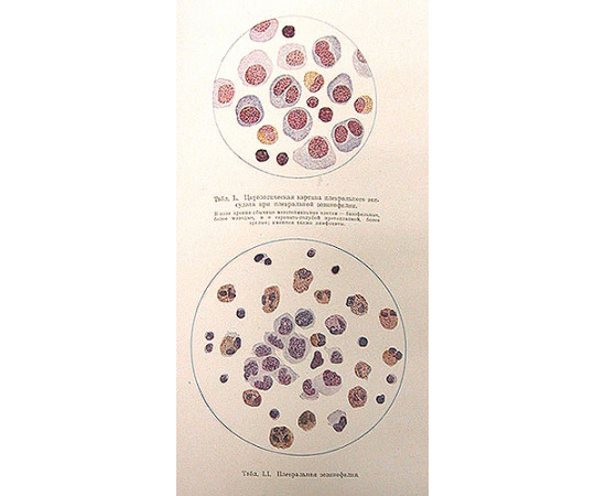 Болезни крови и кроветворной системы (Клиническая гематология и цитология)
