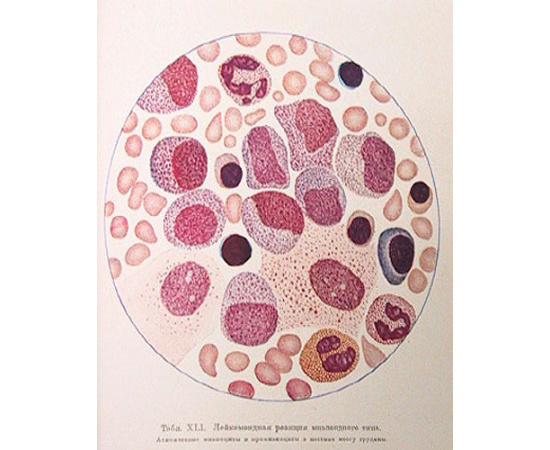 Болезни крови и кроветворной системы (Клиническая гематология и цитология)