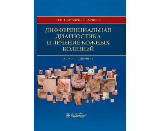 Потекаев Николай Николаевич, Акимов Всеволод Георгиевич. Дифференциальная диагностика и лечение кожных болезней. Атлас-справочник