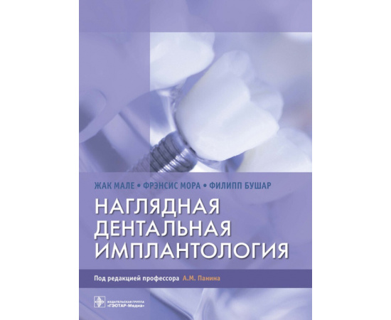 Мале Ж., Мора Ф., Бушар Ф. Наглядная дентальная имплантология.