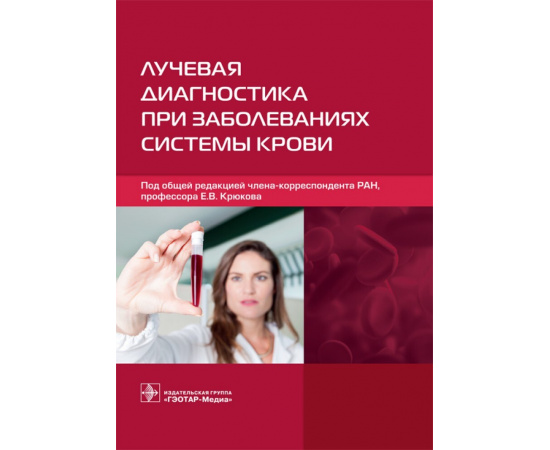 Крюков Е.В. Лучевая диагностика при заболеваниях системы крови.