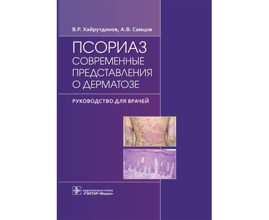 Хайрутдинов В.Р., Самцов А.В. Псориаз. Современные представления о дерматозе