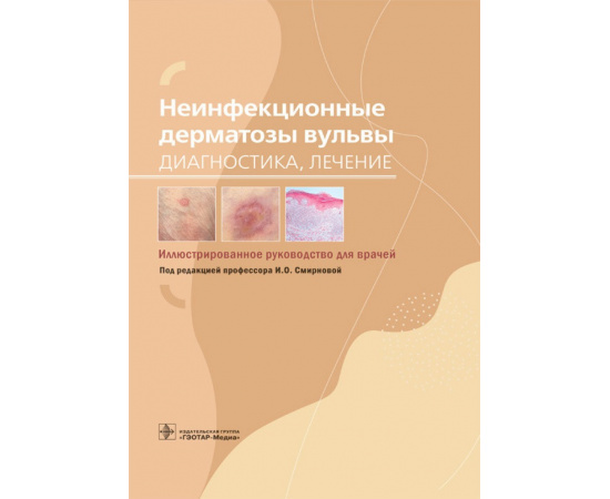 Смирнова И.О. Неинфекционные дерматозы вульвы. Диагностика, лечение. Иллюстрированное руководство для врачей