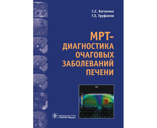 Труфанов Геннадий Евгеньевич, Багненко Сергей Сергеевич. МРТ-диагностика очаговых заболеваний печени.