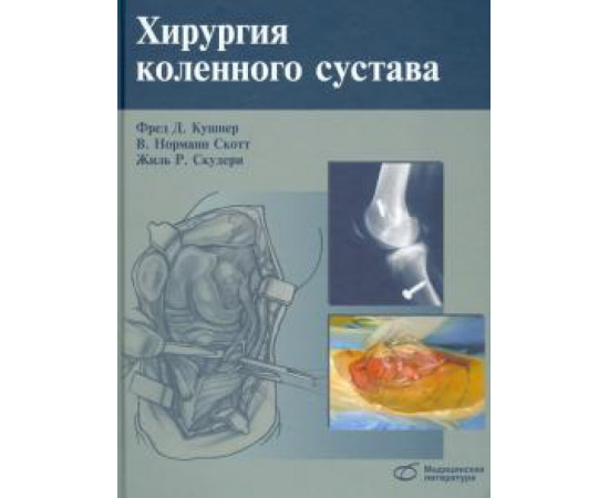 Кушнер Ф.Д. Хирургия коленного сустава.