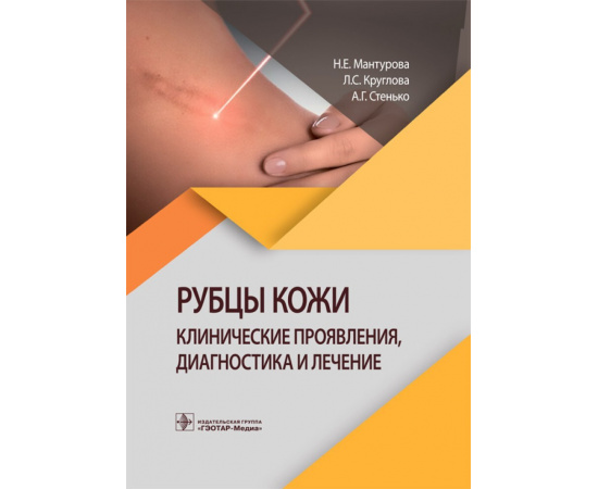 Мантурова Н.Е., Круглова Л.С., Стенько А.Г. Рубцы кожи. Клинические проявления, диагностика и лечение
